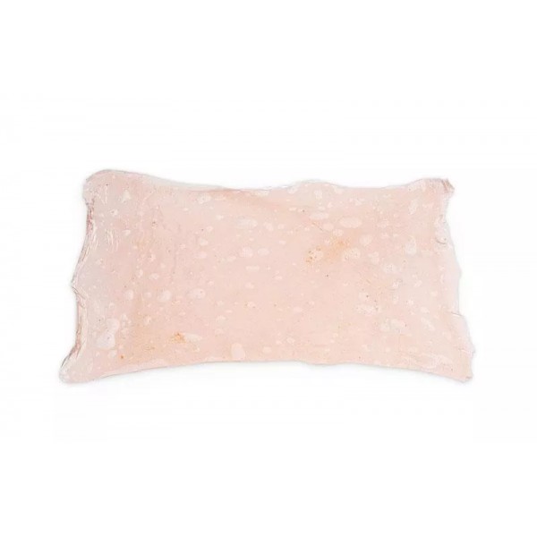 Simulated Burns – Προσομοιωμένα Εγκαύματα 1ου Βαθμού