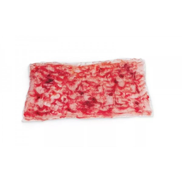 Simulated Burns – Προσομοιωμένο Έγκαυμα 2ου Βαθμού (Βαθύ)