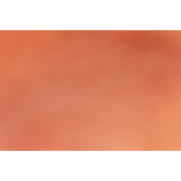 Wound Moulage "1st Degree Burn" – Προσομοίωση Εγκαύματος 1ου Βαθμού