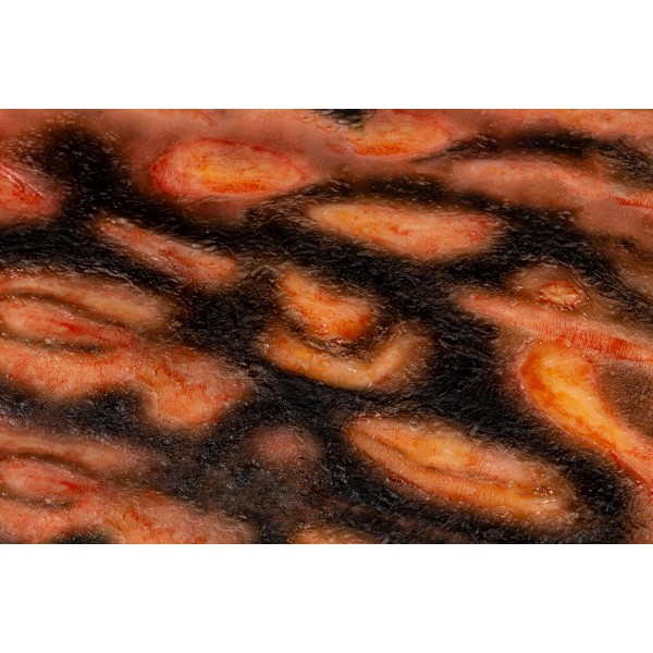 Wound Moulage "3rd Degree Burn" – Προσομοίωση Εγκαύματος 3ου Βαθμού 2