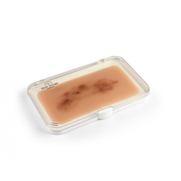 Wound Moulage "Fresh Hematoma" – Προσομοίωση Φρέσκου Αιματώματος