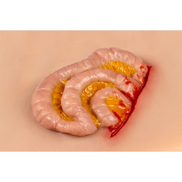 Wound Moulage "Protruding Small Intestines" – Προσομοίωση Εξόδου Λεπτού Εντέρου από Κοιλιακό Τραύμα