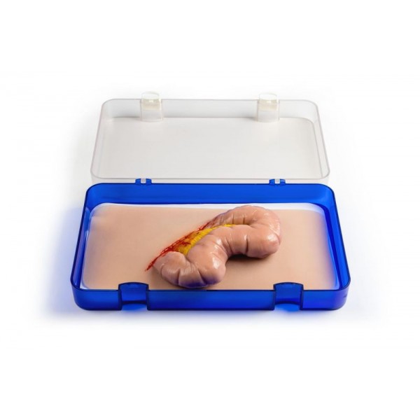 Wound Moulage "Protrusion of Large Intestines" – Προσομοίωση Εξόδου Εντέρου από Κοιλιακό Τραύμα