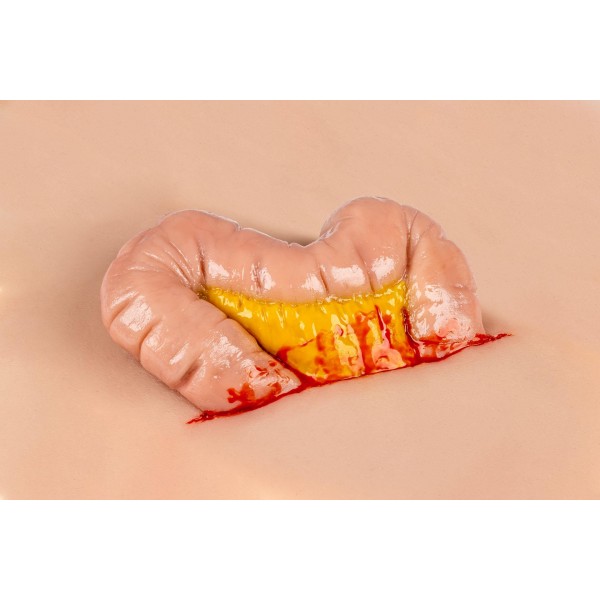 Wound Moulage "Protrusion of Large Intestines" – Προσομοίωση Εξόδου Εντέρου από Κοιλιακό Τραύμα