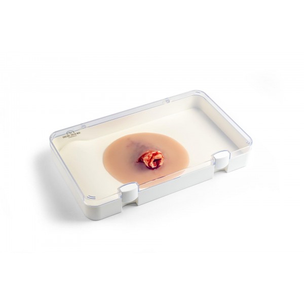 Wound Presentation "Open Fracture Ankle Joint" – Προσομοίωση Ανοικτού Κατάγματος στην Άρθρωση του Αστραγάλου