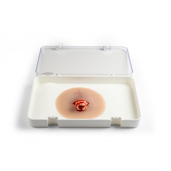 Wound Presentation "Open Fracture Ankle Joint" – Προσομοίωση Ανοικτού Κατάγματος στην Άρθρωση του Αστραγάλου