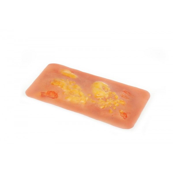 Wound Moulage "2nd Degree Burn" – Προσομοίωση Εγκαύματος 2ου Βαθμού Wound Moulage "2nd Degree Burn" – Προσομοίωση Εγκαύματος 2ου Βαθμού