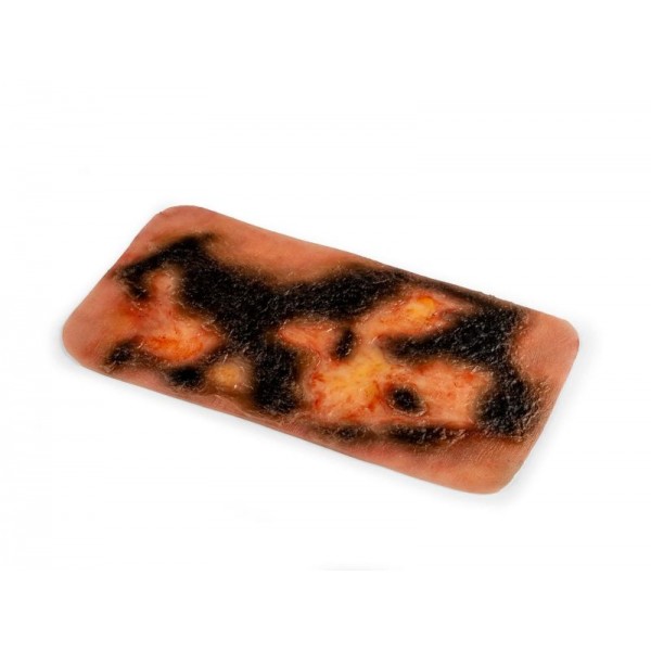 Wound Moulage "3rd Degree Burn" – Προσομοίωση Εγκαύματος 3ου Βαθμού Wound Moulage "3rd Degree Burn" – Προσομοίωση Εγκαύματος 3ου Βαθμού