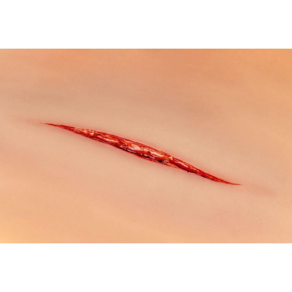 Wound Moulage "Throat Cut" – Προσομοίωση Τραύματος στον Λαιμό