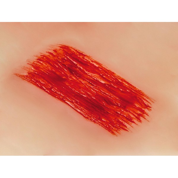 Wound Moulage "Abrasion" – Προσομοίωση Εκδοράς Wound Moulage "Abrasion" – Προσομοίωση Εκδοράς