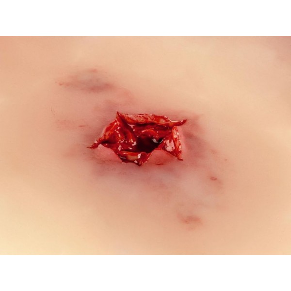 Wound Moulage "Bullet Exit Hole" – Προσομοίωση Τραύματος Εξόδου Σφαίρας Wound Moulage "Bullet Exit Hole" – Προσομοίωση Τραύματος Εξόδου Σφαίρας