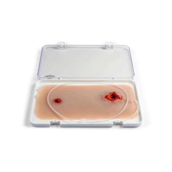 Wound Moulage – Τραύμα από Σφαίρα στο Πόδι με Λειτουργία Αιμορραγίας