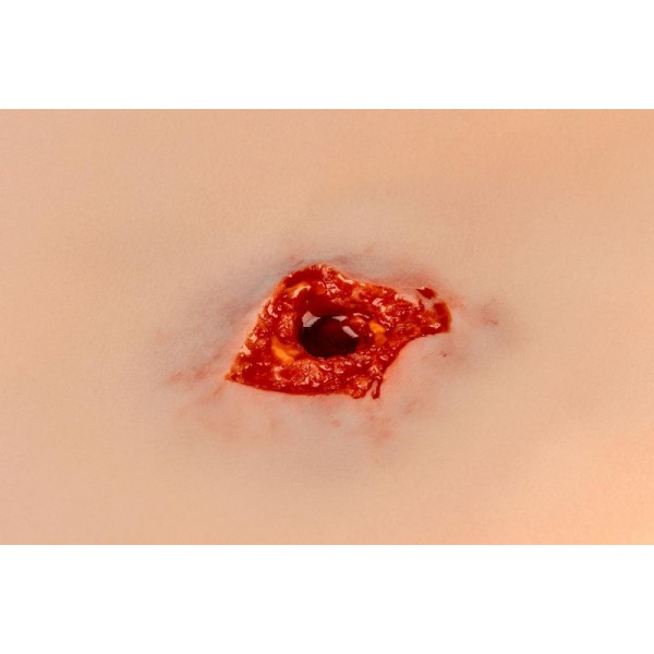 Wound Moulage – Τραύμα από Σφαίρα στο Πόδι με Λειτουργία Αιμορραγίας Wound Moulage – Τραύμα από Σφαίρα στο Πόδι με Λειτουργία Αιμορραγίας