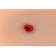 Wound Moulage – Τραύμα από Σφαίρα στο Πόδι με Λειτουργία Αιμορραγίας Wound Moulage – Τραύμα από Σφαίρα στο Πόδι με Λειτουργία Αιμορραγίας