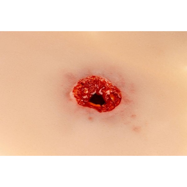 Wound Moulage – Τραύμα από Σφαίρα στο Χέρι με Λειτουργία Αιμορραγίας