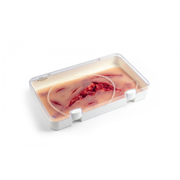Wound Moulage – Μεγάλη Ρήξη Δέρματος με Λειτουργία Αιμορραγίας