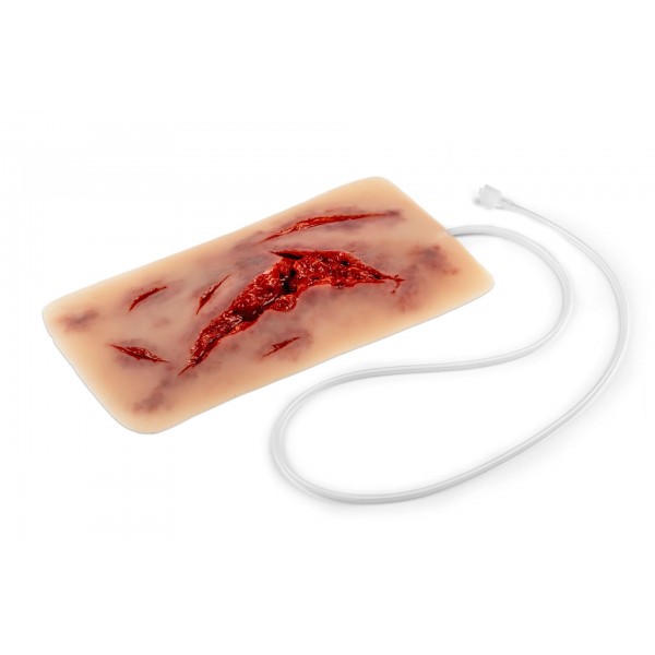 Wound Moulage – Μεγάλη Ρήξη Δέρματος με Λειτουργία Αιμορραγίας