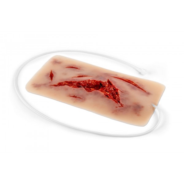 Wound Moulage – Μεγάλη Ρήξη Δέρματος με Λειτουργία Αιμορραγίας