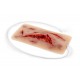 Wound Moulage – Μεγάλη Ρήξη Δέρματος με Λειτουργία Αιμορραγίας