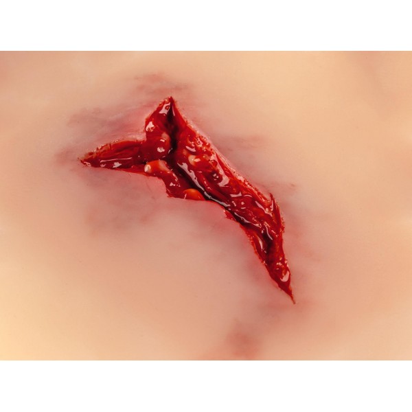 Wound Moulage "Laceration" – Προσομοίωση Ρήξης Δέρματος Wound Moulage "Laceration" – Προσομοίωση Ρήξης Δέρματος