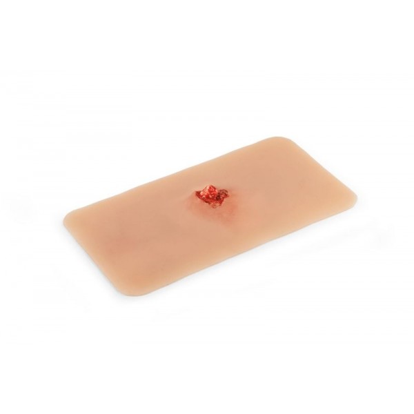 Wound Moulage – Ανοιχτό Κάταγμα Οστού Άνω Άκρου με Λειτουργία Αιμορραγίας