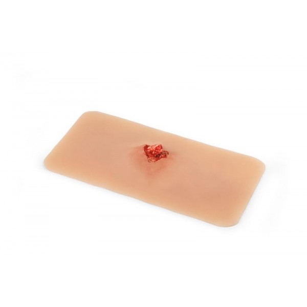 Wound Moulage – Ανοιχτό Κάταγμα Οστού Άνω Άκρου με Λειτουργία Αιμορραγίας