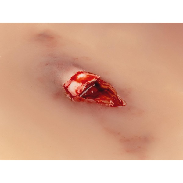 Wound Moulage "Open Fracture" – Προσομοίωση Ανοιχτού Κατάγματος