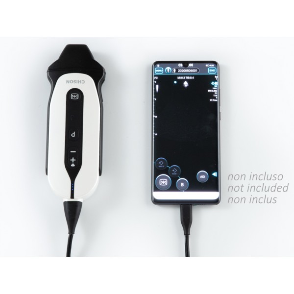  SONOEYE P3 DIGITAL COLOUR DOPPLER - Phase Array Probe
