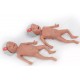 NENA Sim Preemie Xact – Προσομοιωτής Πρόωρου Νεογνού NENA Sim Preemie Xact – Προσομοιωτής Πρόωρου Νεογνού