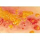 Wound Moulage "2nd Degree Burn" – Προσομοίωση Εγκαύματος 2ου Βαθμού 2