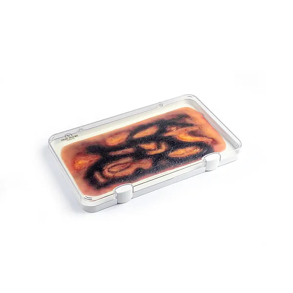 Wound Moulage "3rd Degree Burn" – Προσομοίωση Εγκαύματος 3ου Βαθμού 2