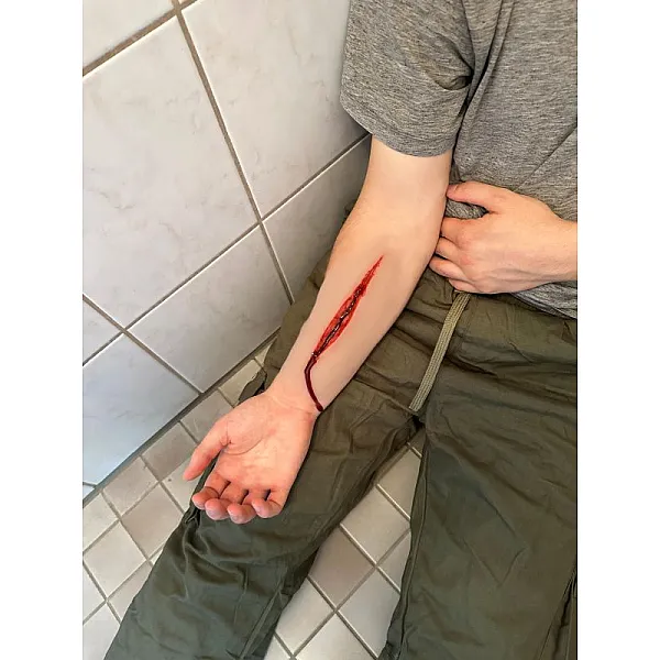 Wound Moulage "Suicide Attempt" – Προσομοίωση Τραύματος Αυτοτραυματισμού