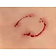 Wound Moulage "Human Bite" – Προσομοίωση Ανθρώπινου Δαγκώματος