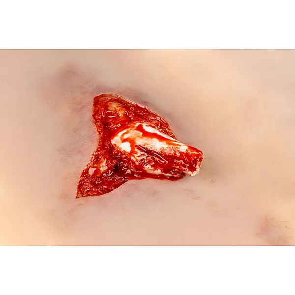 Wound Moulage – Ανοιχτό Κάταγμα Ποδιού με Λειτουργία Αιμορραγίας Wound Moulage – Ανοιχτό Κάταγμα Ποδιού με Λειτουργία Αιμορραγίας
