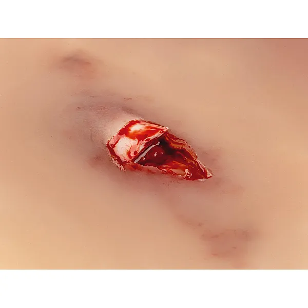 Wound Moulage "Open Fracture" – Προσομοίωση Ανοιχτού Κατάγματος
