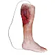 Emergency Lower Leg – Εκπαιδευτικό Μοντέλο Ποδιού με Τραύμα από Έκρηξη
