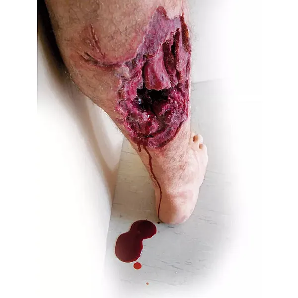Emergency Lower Leg – Εκπαιδευτικό Μοντέλο Ποδιού με Τραύμα από Έκρηξη