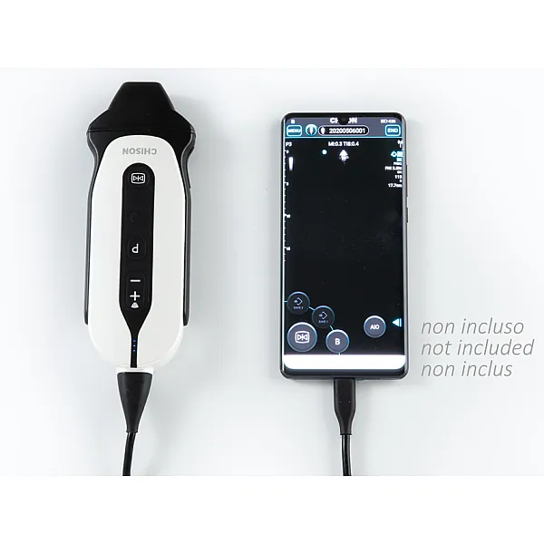  SONOEYE P3 DIGITAL COLOUR DOPPLER - Phase Array Probe