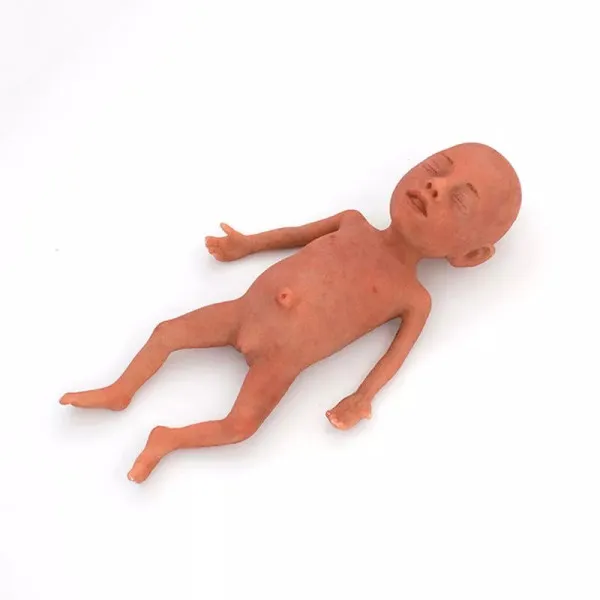 NENA Sim Preemie Xact – Προσομοιωτής Πρόωρου Νεογνού