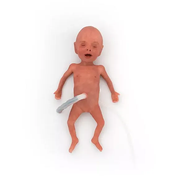 NENA Sim Preemie Xcel – Προσομοιωτής Πρόωρου Νεογνού NENA Sim Preemie Xcel – Προσομοιωτής Πρόωρου Νεογνού